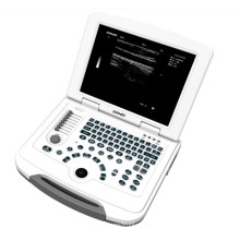 DAWEI DW-500 Cheapest 2d china portable ultrasound machine price